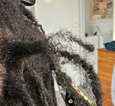 root-reconstruction-interlocking-damage-before