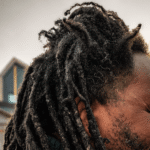 dreadlock repair damaged thinning roots before specialist correction