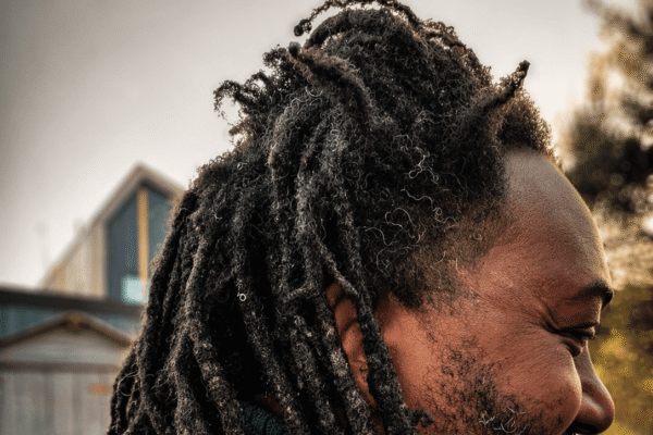 dreadlock repair damaged thinning roots before specialist correction