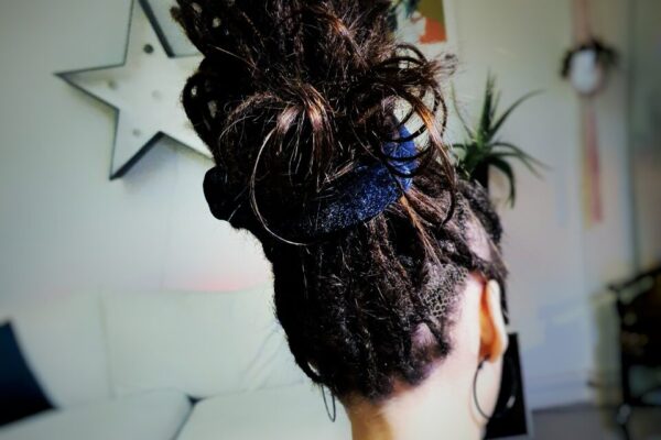 specialist dreadlock transformation for thinning hair and bald areas