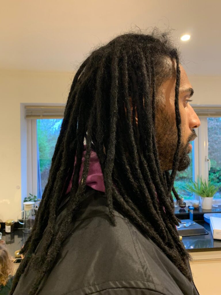 thinning dreadlock roots early warning signs close up