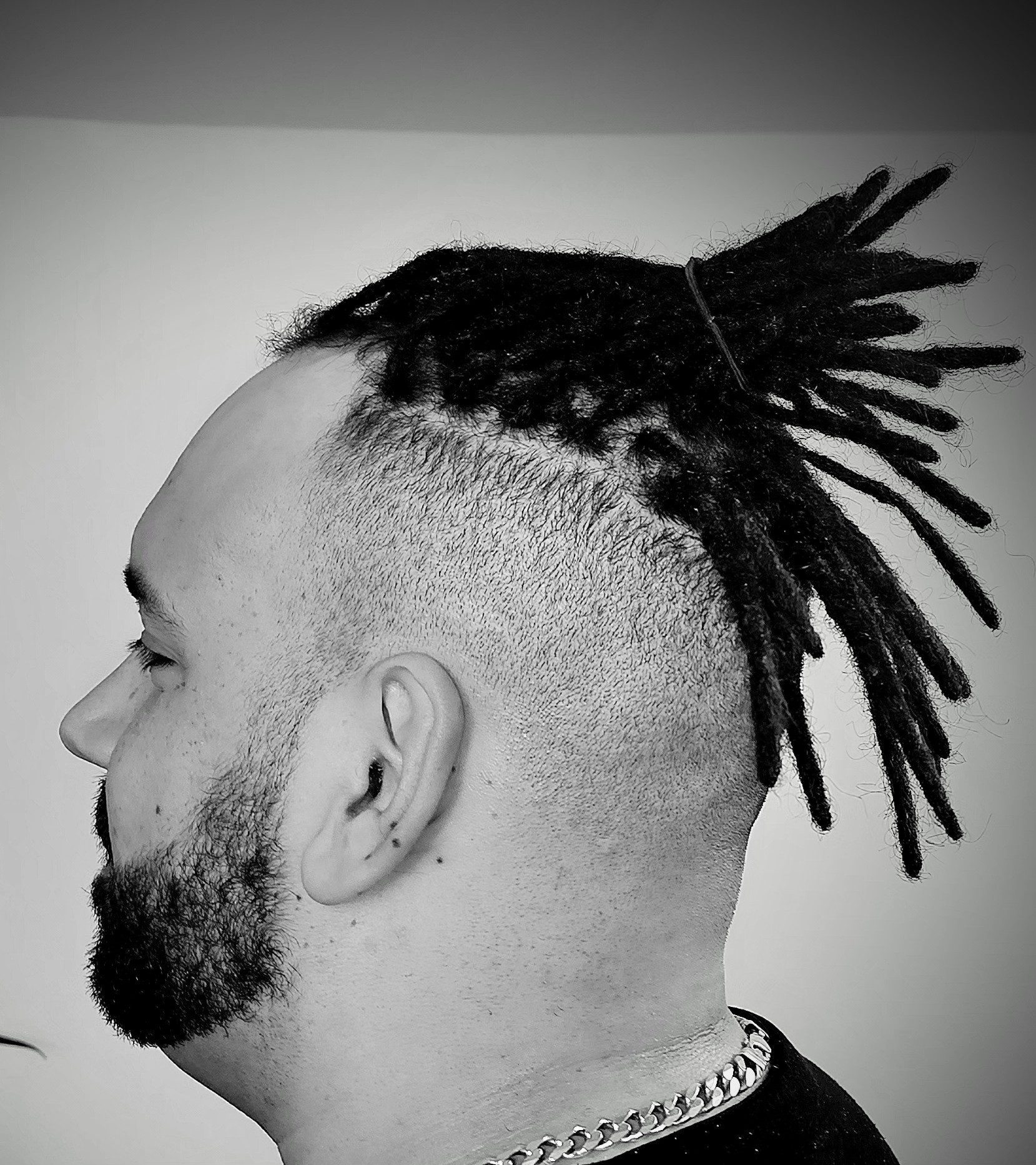 thinning-hair-dreadlocks-hero-image.jpg