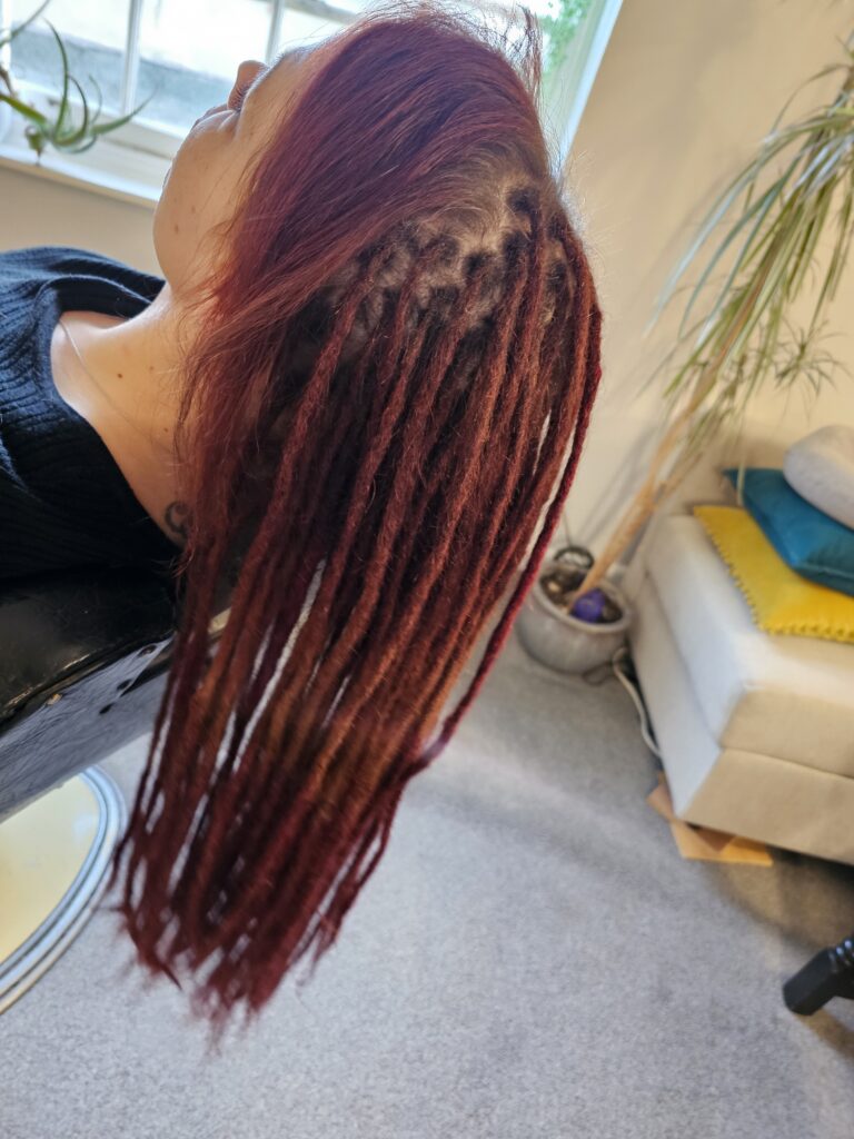 Thinning_crown_dreadlocks_roots
