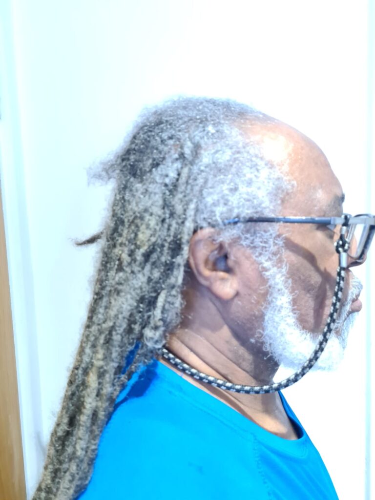 fragile-root-dreadlocks-before-specialist-assessment.2jpg