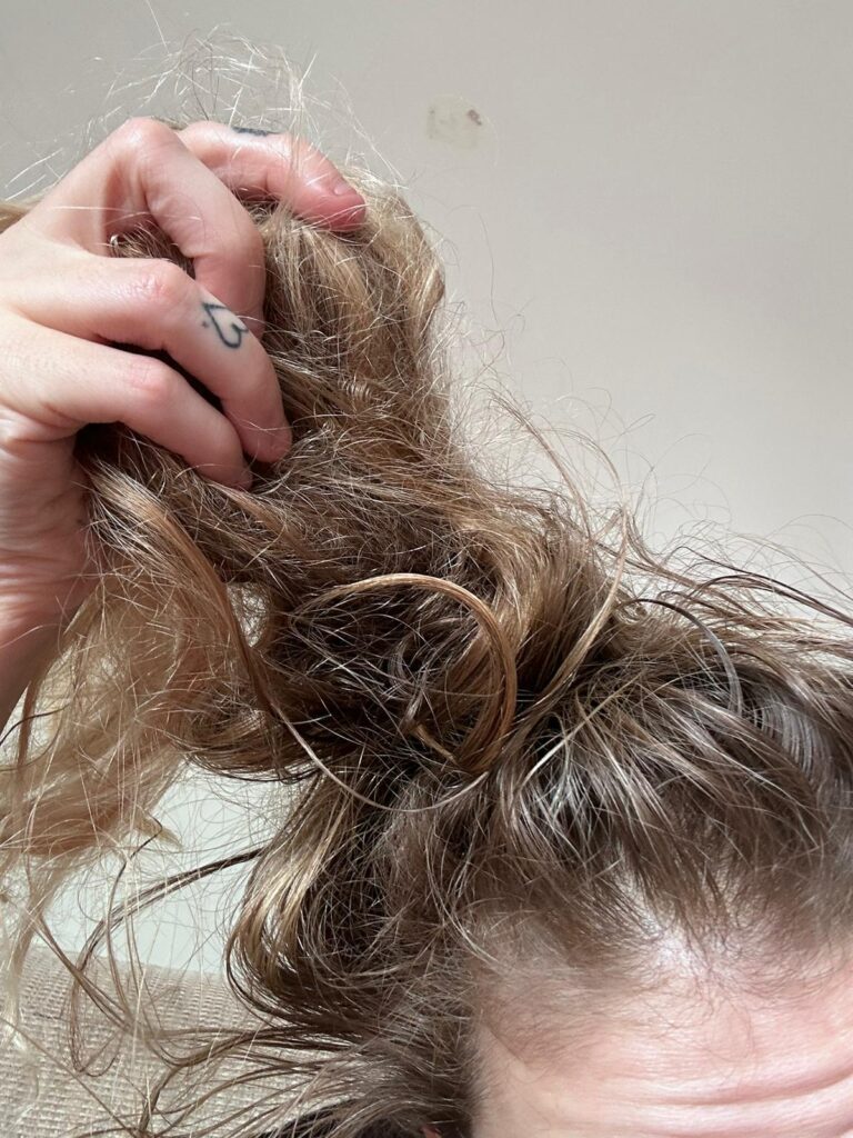 dreadlock-extensions-before-and-after-thinning-hairline.jpg
