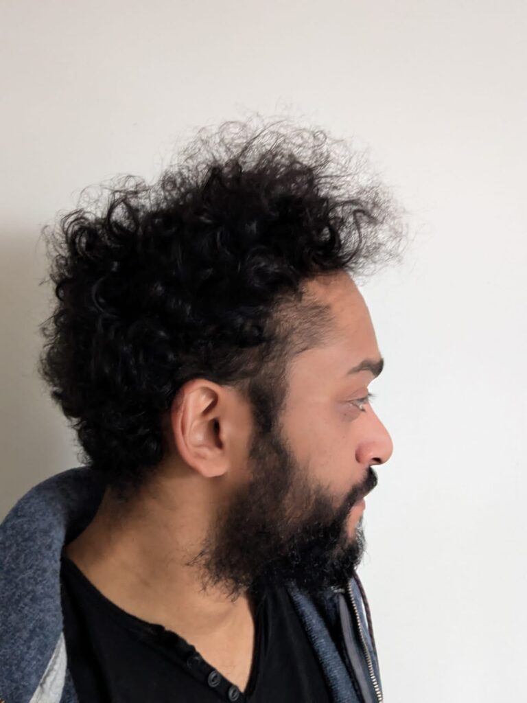 fine-hair-dreadlocks-before-specialist-plan.jpg