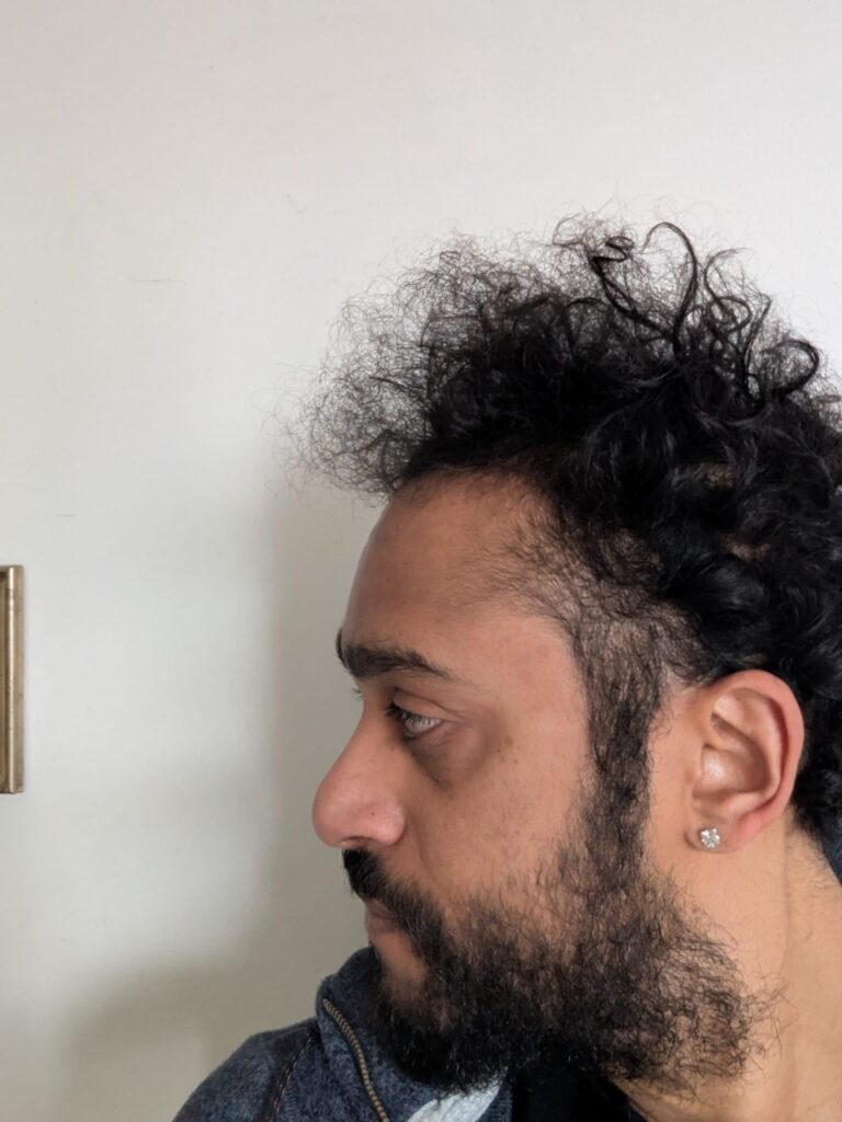 weak-edge-dreadlocks-specialist-repair.jpg