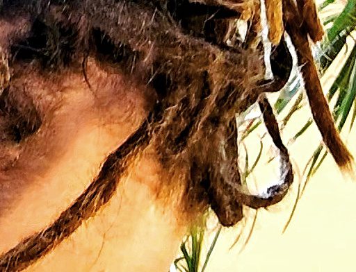 Fragile front hairline and dreadlock roots requiring specialist assessment