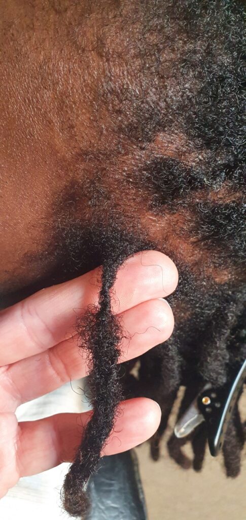Thinning and joined dreadlock roots before specialist repair assessment