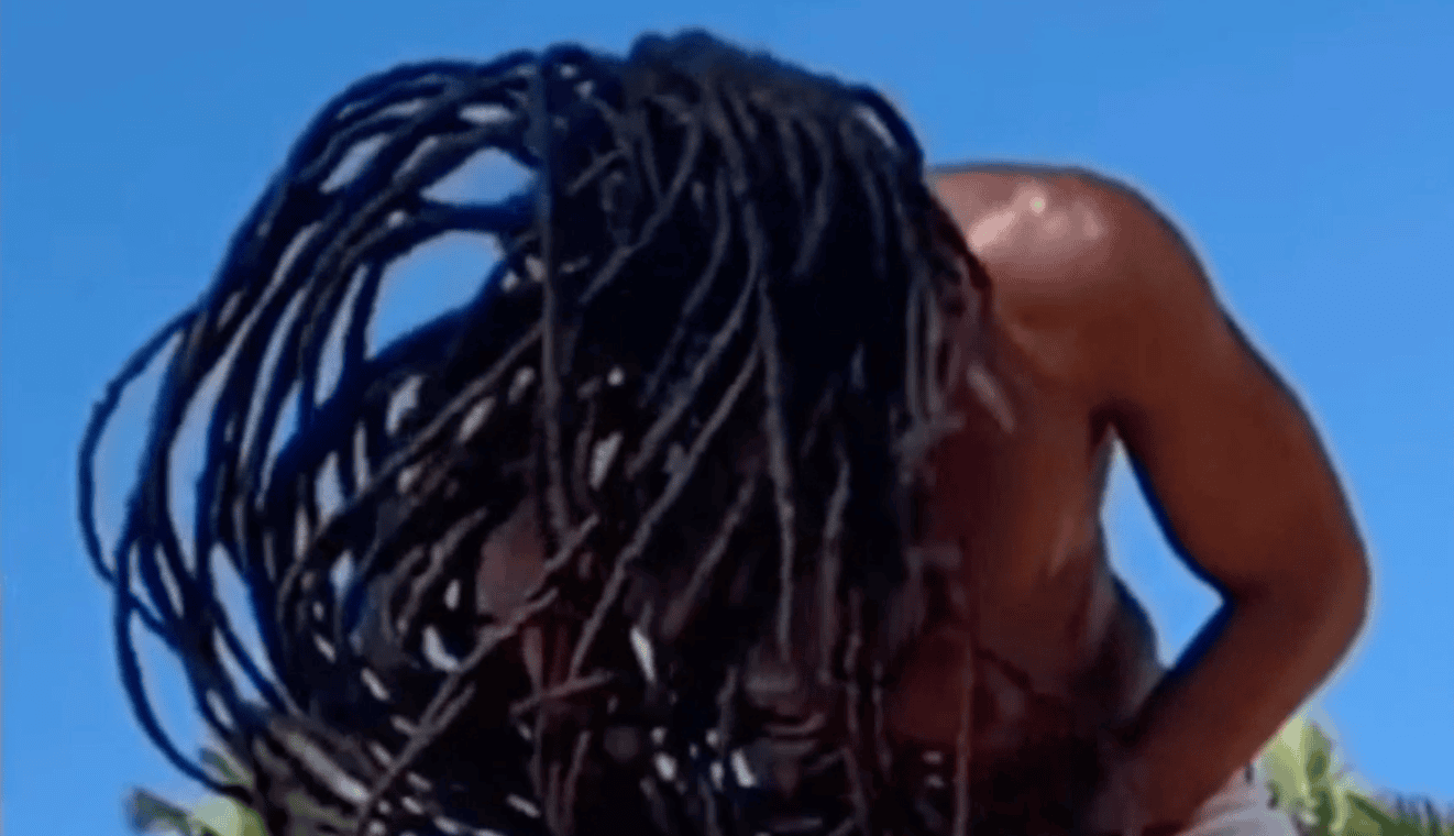 Specialist assessment for dreadlocks with uneven hair density
