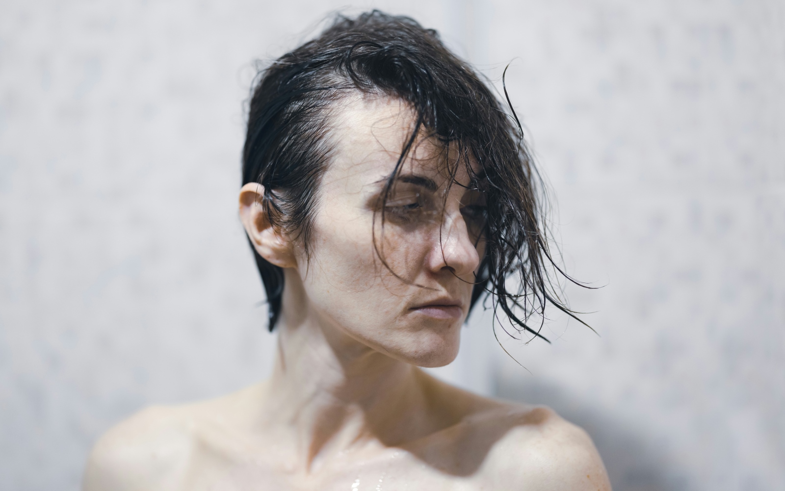 traction-alopecia-dreadlocks-assessment-hero