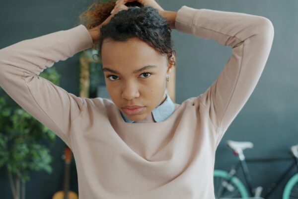 Uneven hair density dreadlocks assessed across the scalp