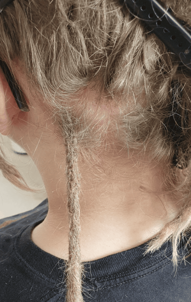 blog-56-thinning-hair-scalp-density-assessment-detail Specialist assessment of scalp visibility and density before dreadlock extensions