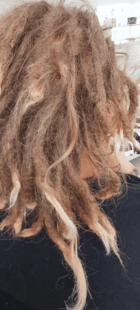 Existing dreadlocks with uneven sections and damage before specialist assessment