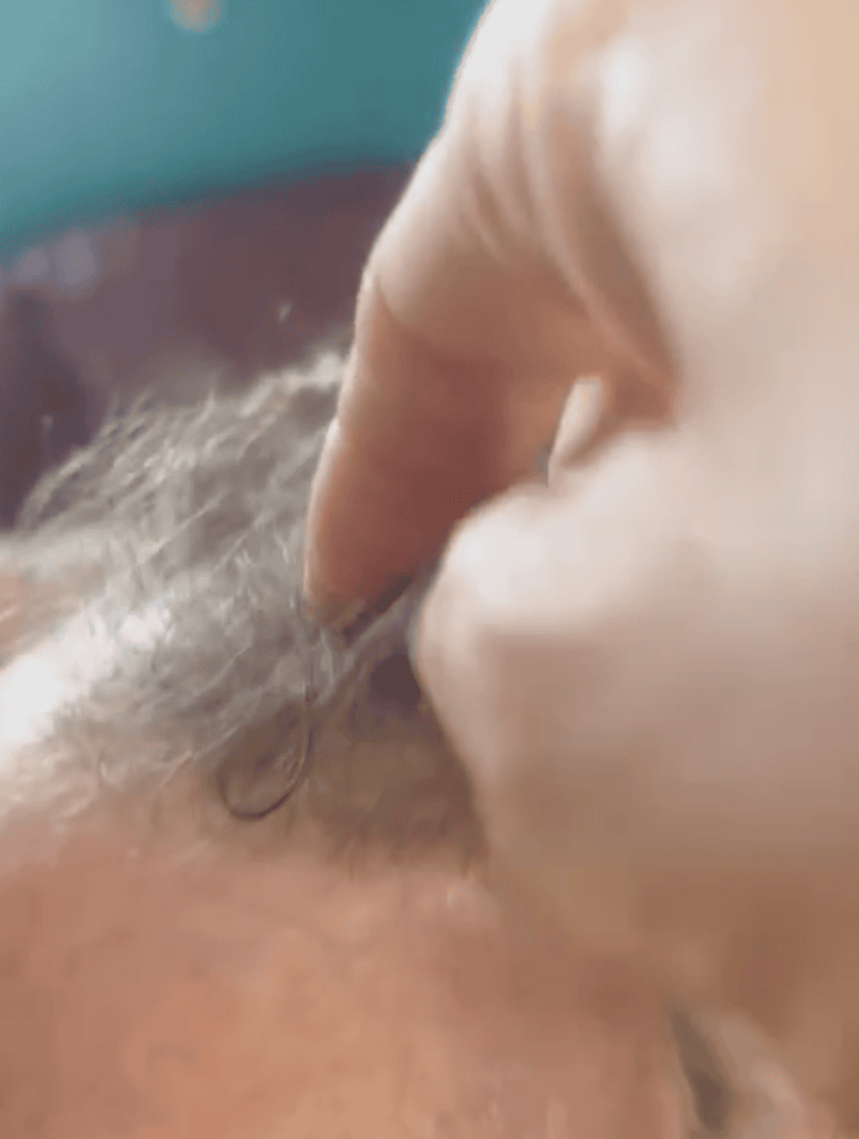 blog-60-fine-thinning-hair-density-assessment Fine thinning hair density before permanent dreadlock extension planning