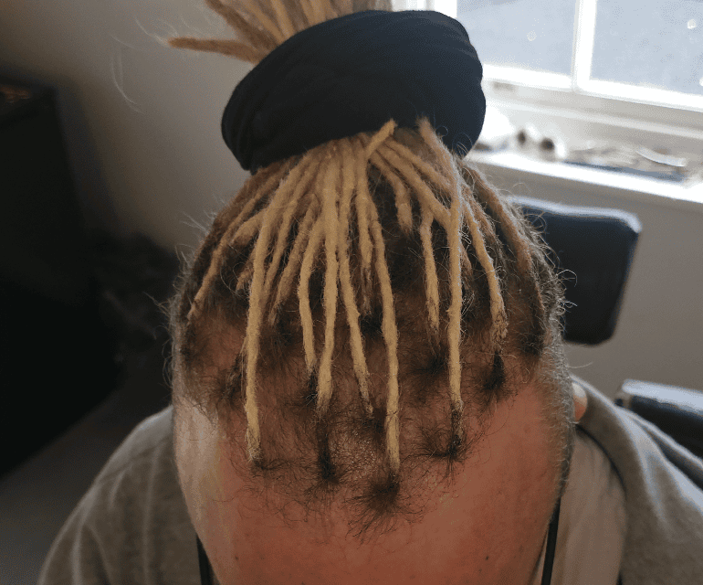 Side view of permanent dreadlock extensions around the face