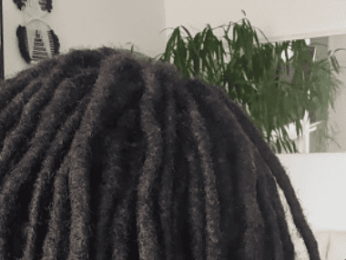 blog65-dreadlocks-hairline-current-support Side view showing the hairline beneath established dreadlocks